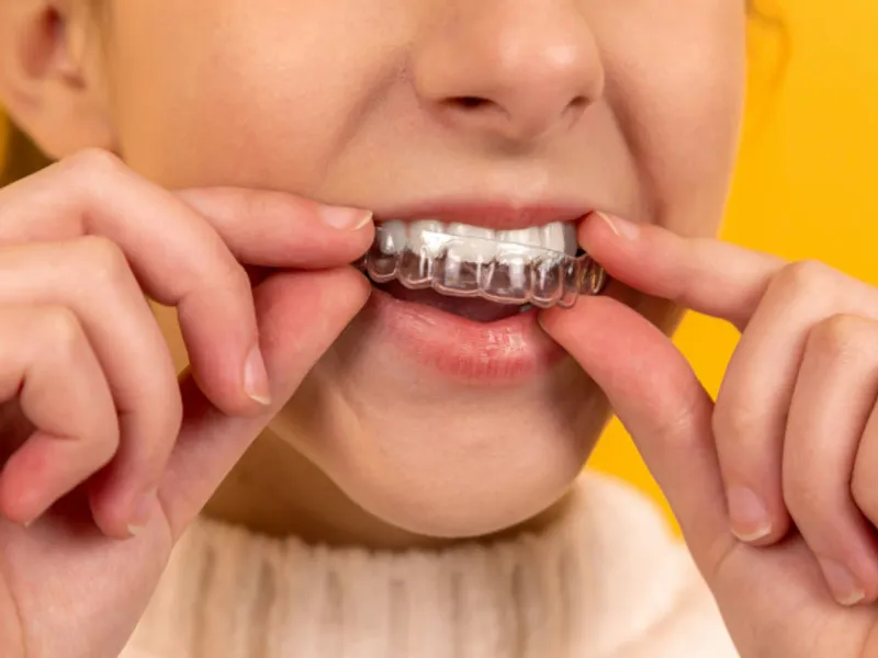 A patient holding a clear aligner or a lifestyle shot of a confident, straight smile.